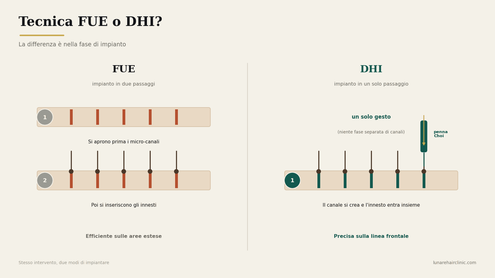 differenza tra FUE e DHI