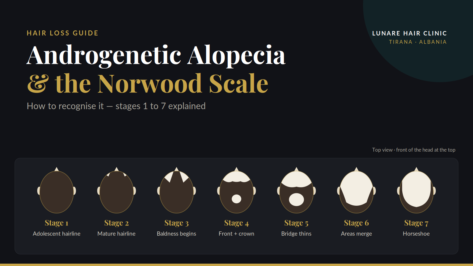 norwood scale