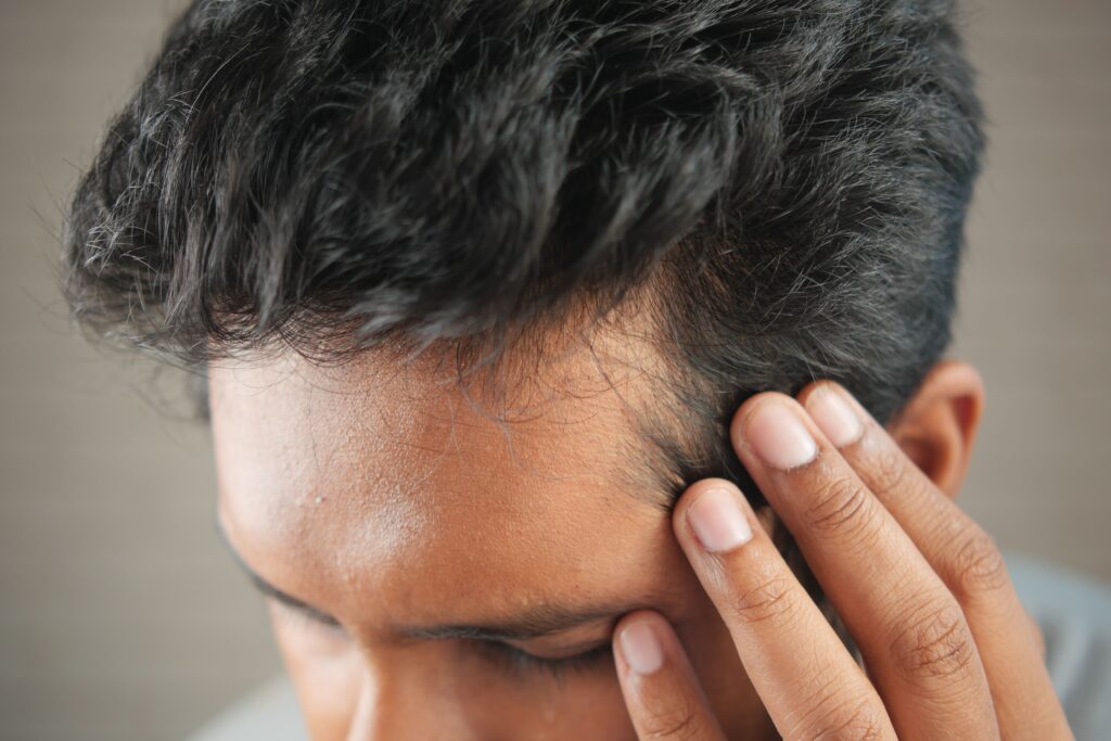 androgenetic alopecia man trasplant
