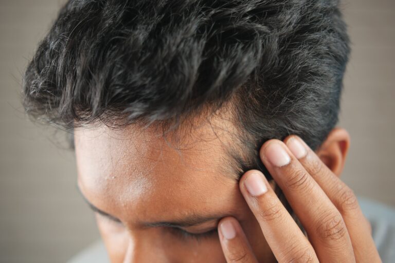 alopecia androgenetica uomo trasplantato